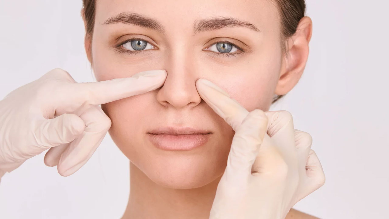 Rinoplastia no quirúrgica con ácido hialurónico Lecce Parma Milán